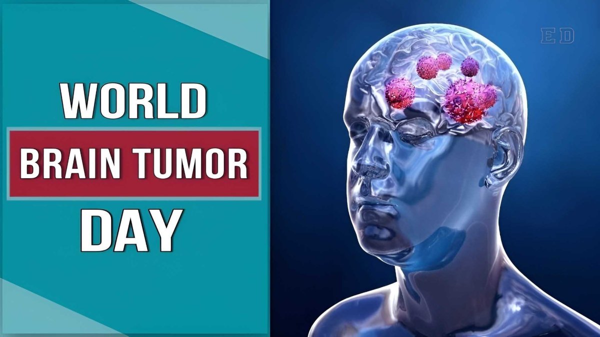 World Brain Tumor Day 2024 : कहीं आपको भी तो नहीं Brain Tumor? ये हो सकते हैं प्रारंभिक संकेत…