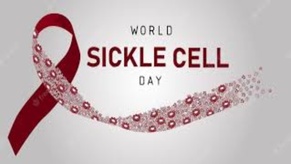 Sickle Cell Anemia Day 2024: मुख्यमंत्री साय ने सिकलसेल जागरूकता शिविर अयोजन के दिए निर्देश, 19 जून को आदिवासी क्षेत्रों के सभी स्वास्थ्य केंद्रों में होगी स्क्रीनिंग…
