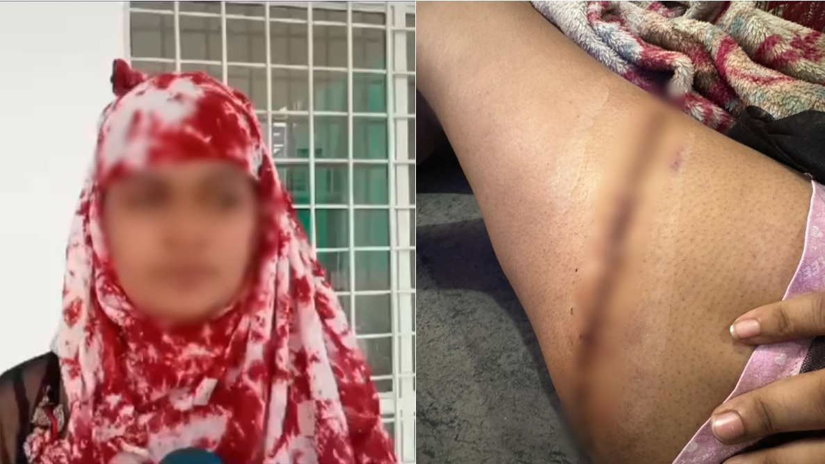 पापा की परियों के बीच चाकूबाजी: युवती ने सहेली का नहाते हुए वीडियो किया वायरल, खफा लड़की ने चाकू से किए ताबड़तोड़ वार, लगे 20 टांके