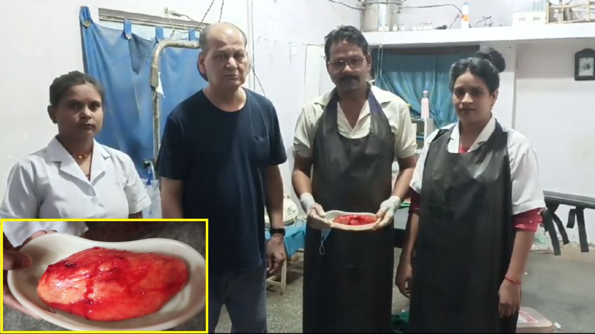 युवक की जांघ से निकाला आधा किलो का ट्यूमर: 3 साल से था परेशान, इतना बड़ा Tumor देख डॉक्टर और परिजन रह गए हैरान