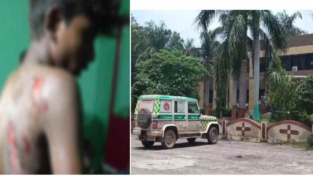 CG NEWS : जलती आग के भट्ठे में धकेलने से नाबालिग घायल, गांव में तनाव का माहौल