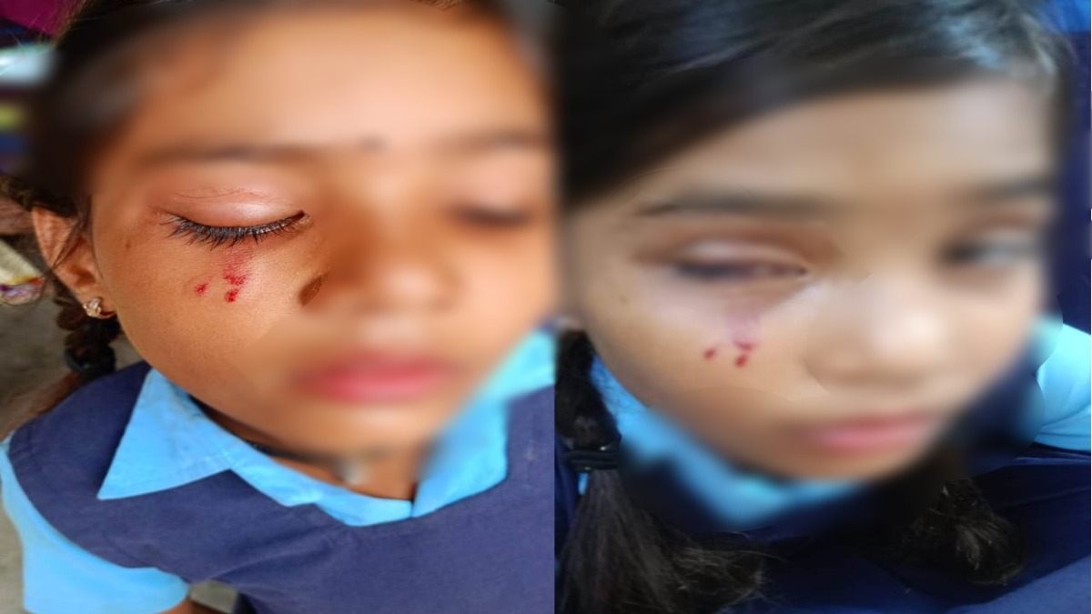 सरकारी स्कूल के हेड मास्टर ने 5 वीं कक्षा की छात्रा से की मारपीट, उचित कार्रवाई की मांग को लेकर युवा कांग्रेस ने दी चेतावनी
