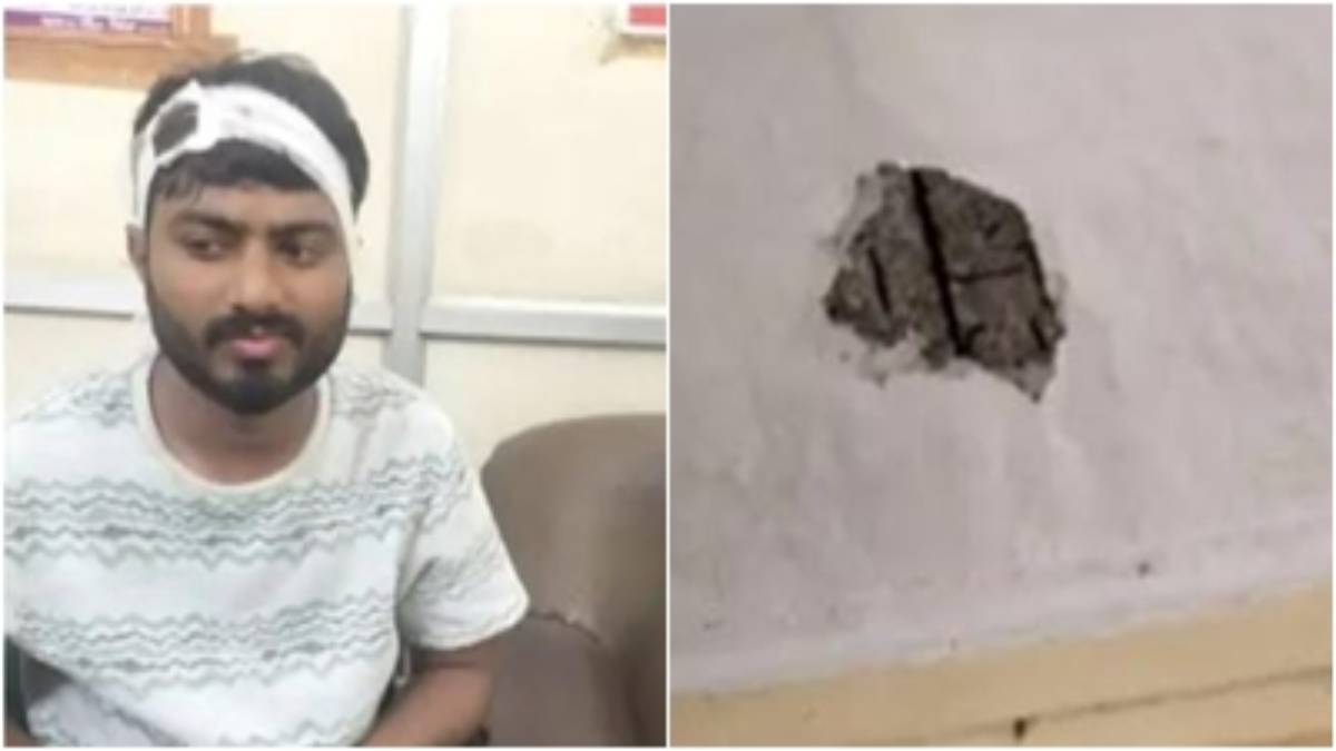 रेलवे स्टेशन पर हादसा: छत का प्लास्टर गिरने से फटा यात्री का सिर, देर से पहुंची एम्बुलेंस 