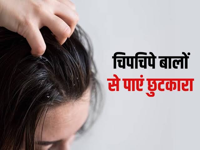 Mansoon Hair Care Tips : बारिश के मौसम में आप भी चिपचिपे बालों से हैं परेशान, तो लगाएं अंडे का हेयर मास्क …