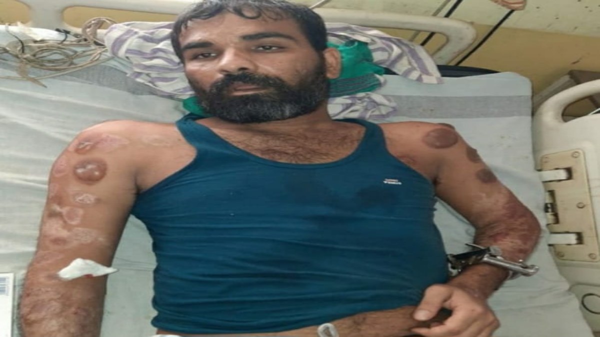 मेडिकल अस्पताल से भागा कैदी: हथकड़ी के साथ हुआ फरार, लकवा का चल रहा था इलाज, मचा हड़कंप 