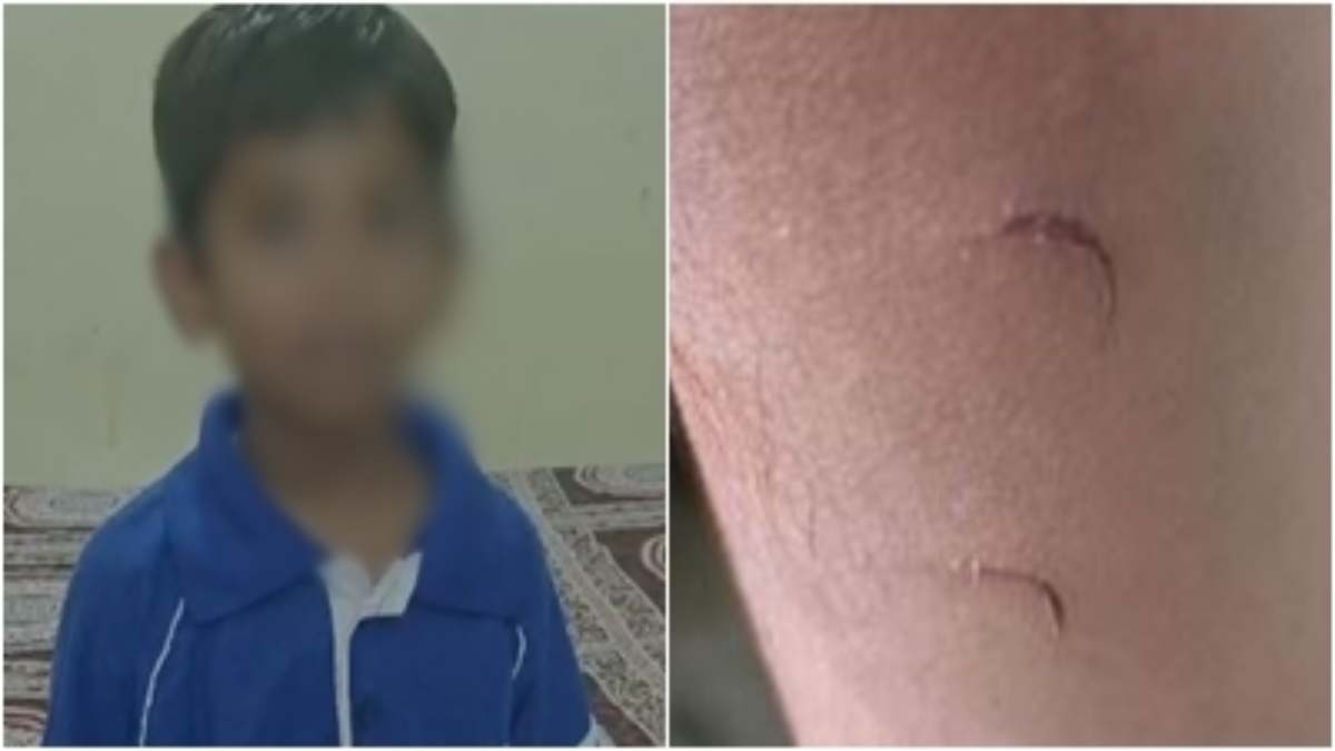 महिला टीचर की हैवानियत: होमवर्क पूरा नहीं करने पर बच्चे को दी ऐसी सजी, माता-पिता का कांप उठा कलेजा