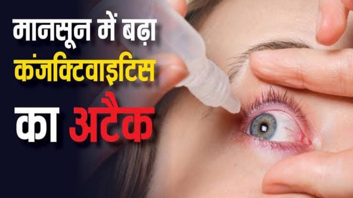मानसून में बढ़ जाता है कंजंक्टिवाइटिस इंफेक्शन का खतरा, अगर आप भी है इसके शिकार, तो इस तरह से करें अपने आंखों की देखभाल…