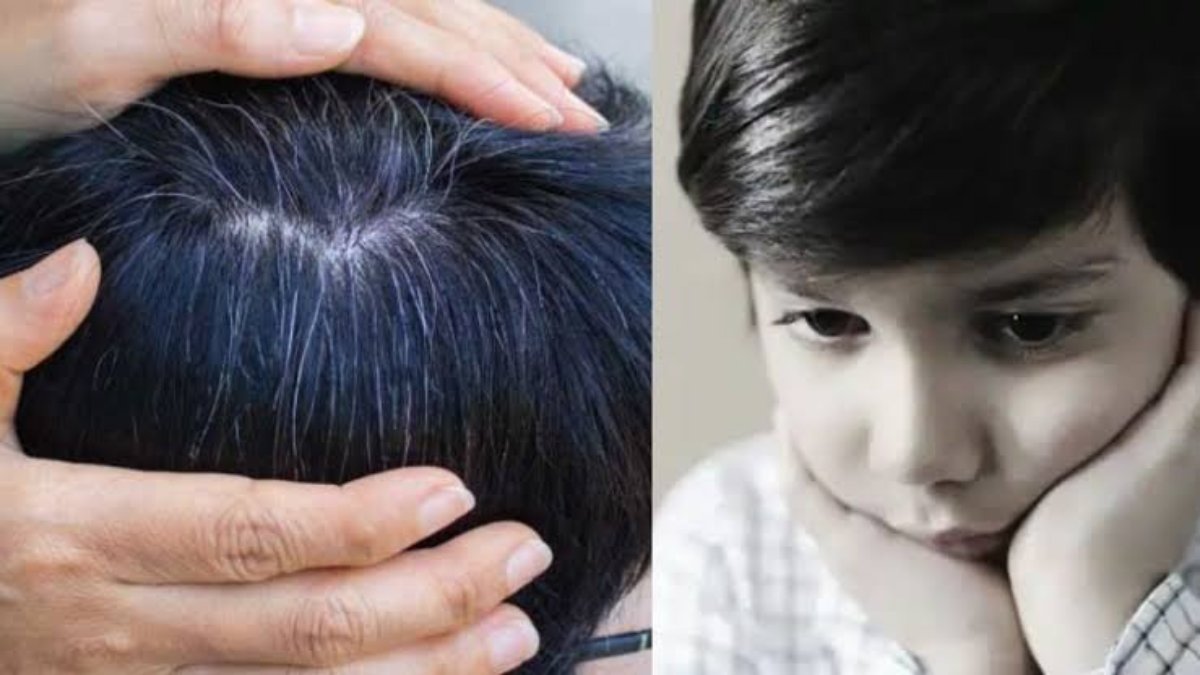 क्या आपके बच्चे के भी सर में दिखने लगे हैं सफेद बाल? तो हो सकती है इन Vitamins की कमी…