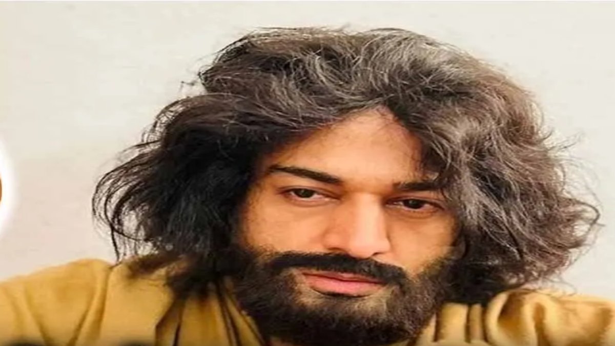 अनुपमा के अनुज को ये क्या हुआ, लुक देखकर फैंस को होने लगी चिंता…