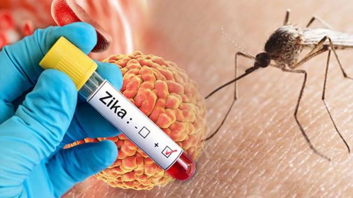 बारिश के साथ Zika Virus ने दी दस्तक, Pregnant Women को है सबसे ज्यादा नुकसान…