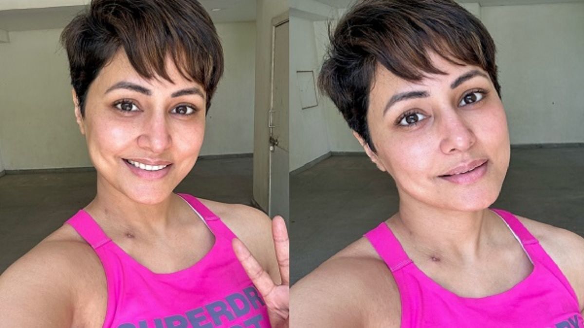 Hina Khan ने फैंस को दिखाया शरीर का जख्म, मुस्कुराते हुए इंस्टाग्राम पर शेयर किया Photos …