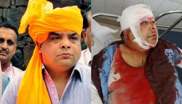 शिव सेना नेता संदीप थापर पर हमला मामले में नया मोड