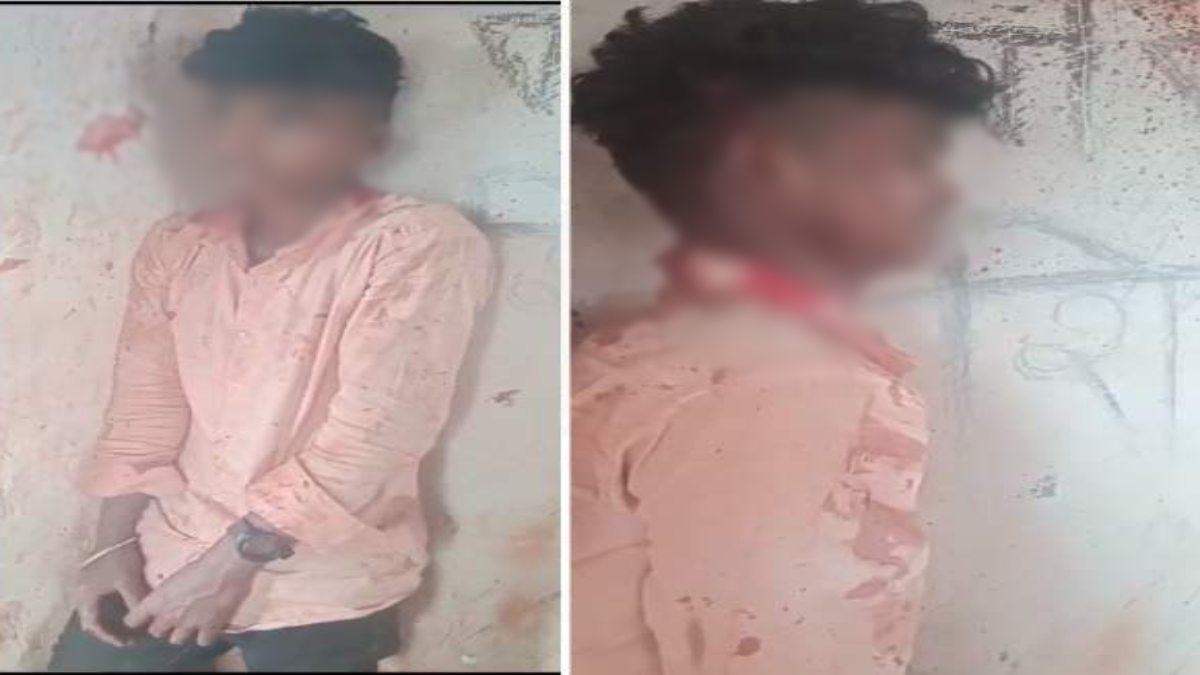 MP में आदिवासी युवक की बेरहमी से पिटाई: बदमाशों ने एक के बाद एक जड़े कई थप्पड़, मार-मारकर फोड़ा सिर