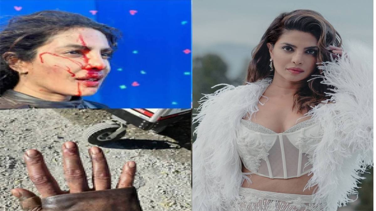 The Bluff: ​प्रियंका चोपड़ा दिखीं लहू-लुहान और चोटिल, कैप्शन लिखकर कही ये बात…
