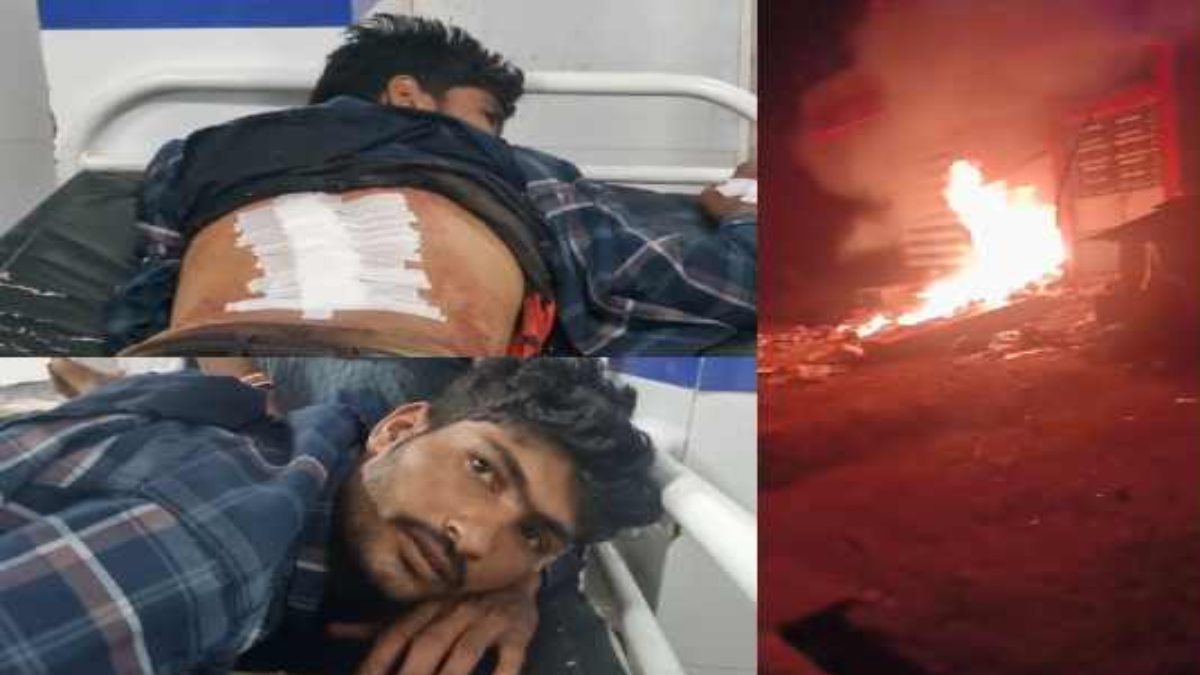 खराब चिकन देने की बात पर विवाद: दुकानदार ने ग्राहक को मारा चाकू, गुस्साए लोगों ने फूंका मकान