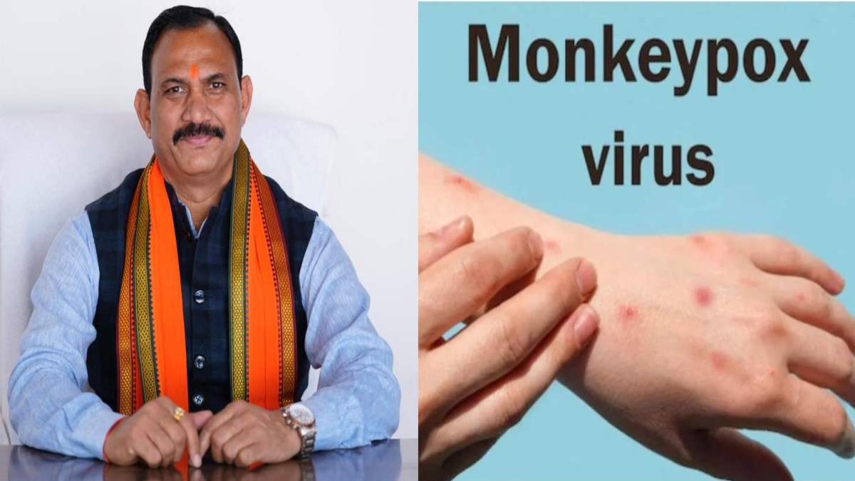 Monkeypox Alert in CG : मंकीपॉक्स को लेकर छत्तीसगढ़ में अलर्ट जारी, स्वास्थ्य मंत्री जायसवाल ने बचाव के लिए दिए सख्त दिशा-निर्देश, जारी की एडवायजरी