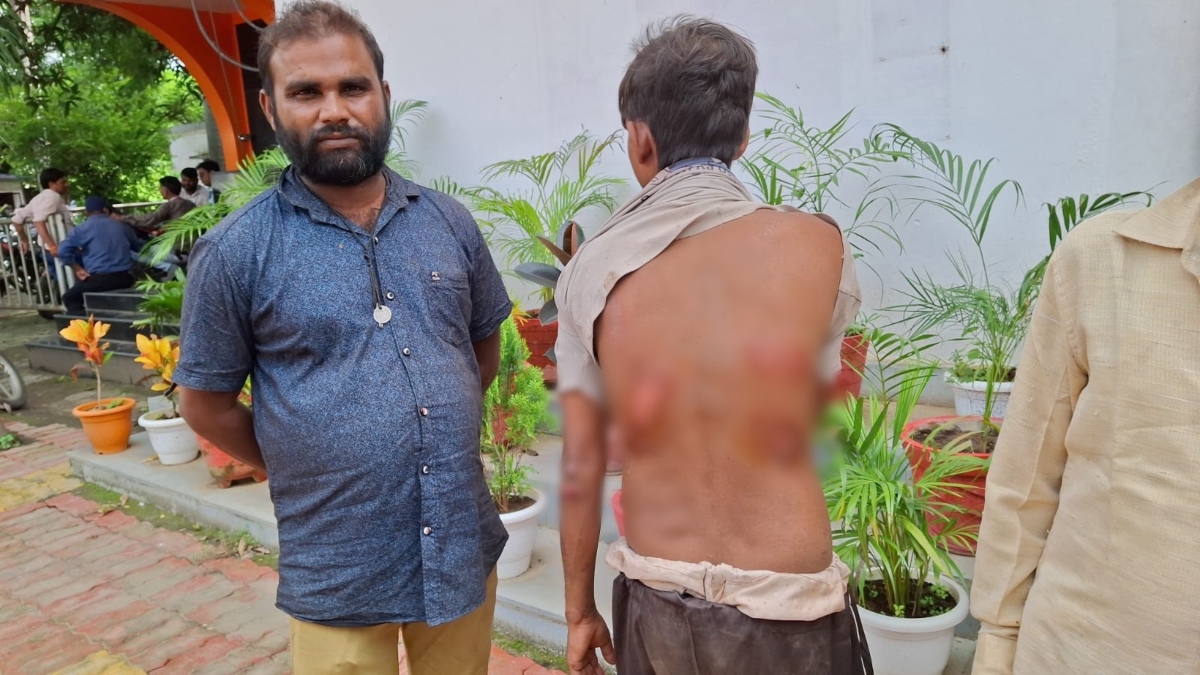 पार्षद पति ने युवक को दी तालिबानी सजा: साथियों के साथ मिलकर लात-घूंसों से की बेरहमी से पिटाई, जानें क्या है पूरा मामला 
