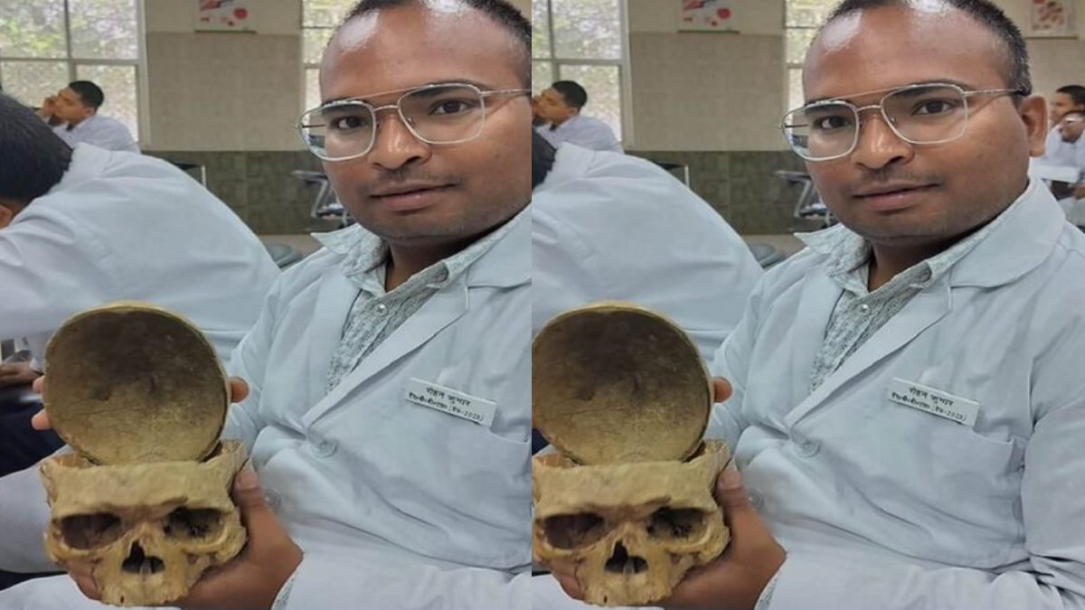 गर्लफ्रेंड संग रह रहे MBBS स्टूडेंट ने की आत्महत्या, लिव इन पार्टनर के दुपट्टे से लगाई फांसी