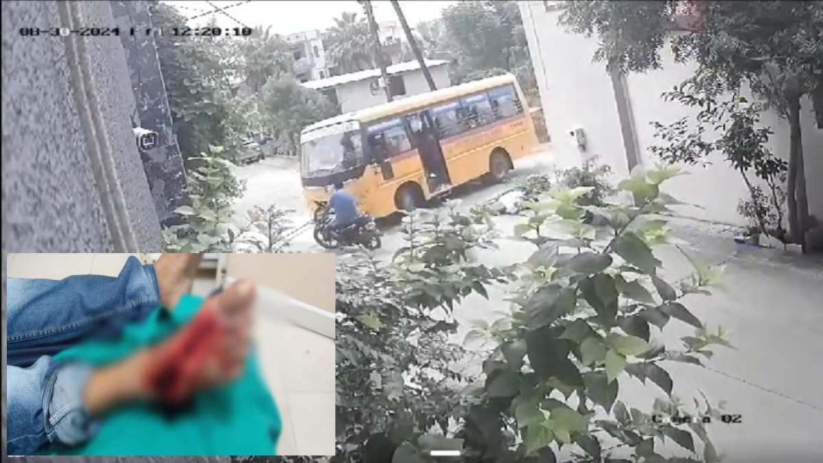 इंसानियत शर्मसार: तीन हॉस्पिटल जाने पर भी किसी ने नहीं की ‘मरहम-पट्टी’, इलाज के लिए भटकता रहा HIV पॉजिटिव मरीज