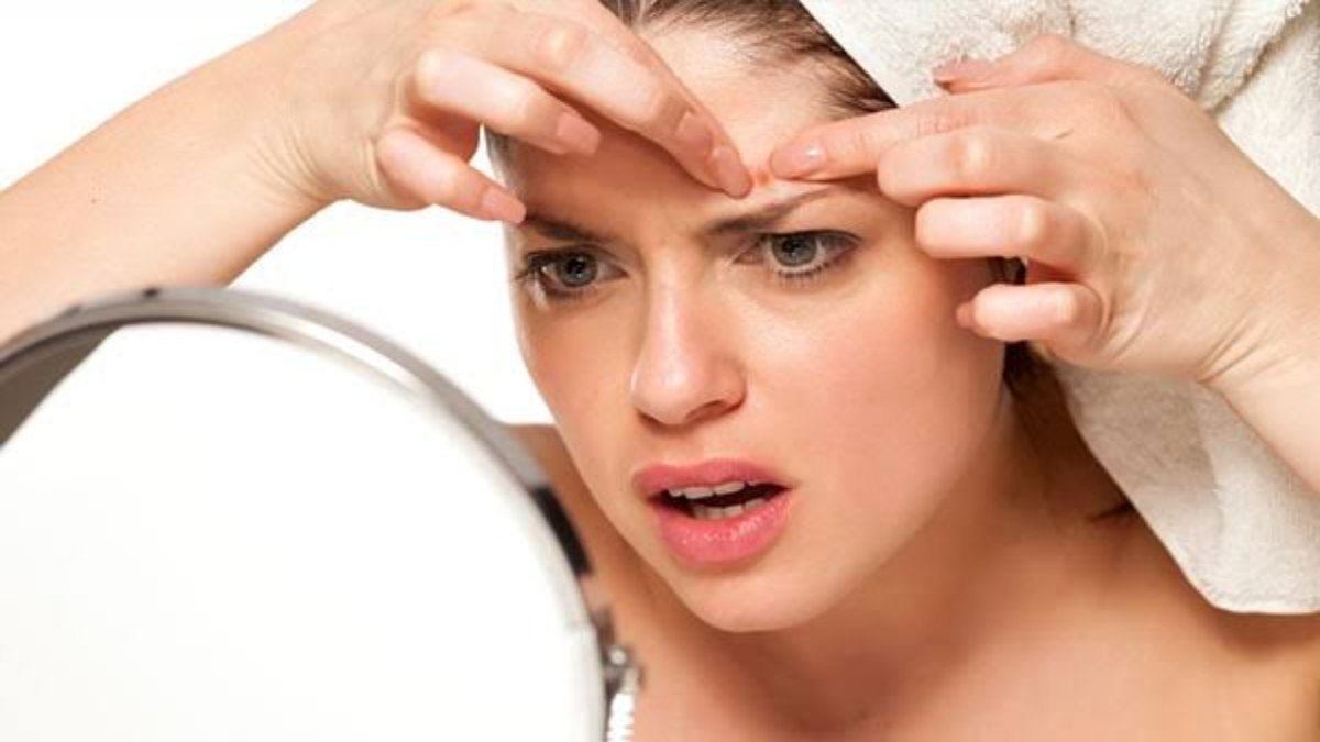 चेहरे में हो गए हैं Pimples, तो उसे छेड़ने की भूल बिल्कुल न करें, नहीं तो हो जाएंगे जिद्दी Dark Spots….