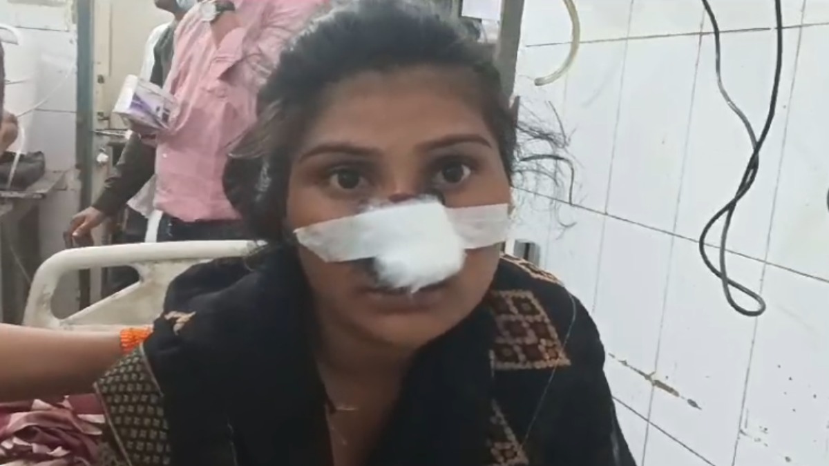 रक्षाबंधन पर मायके जाना चाहती थी पत्नी, मना करने पर हुआ विवाद, पति ने काट दी नाक, हालत गंभीर