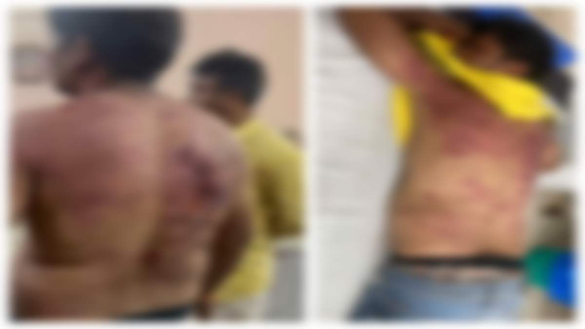 नशेड़ियों का आतंक: नशे के लिए नहीं दिए पैसे तो तीन कर्मचारियों को बंधक बनाकर की जमकर धुनाई, जांच में जुटी पुलिस