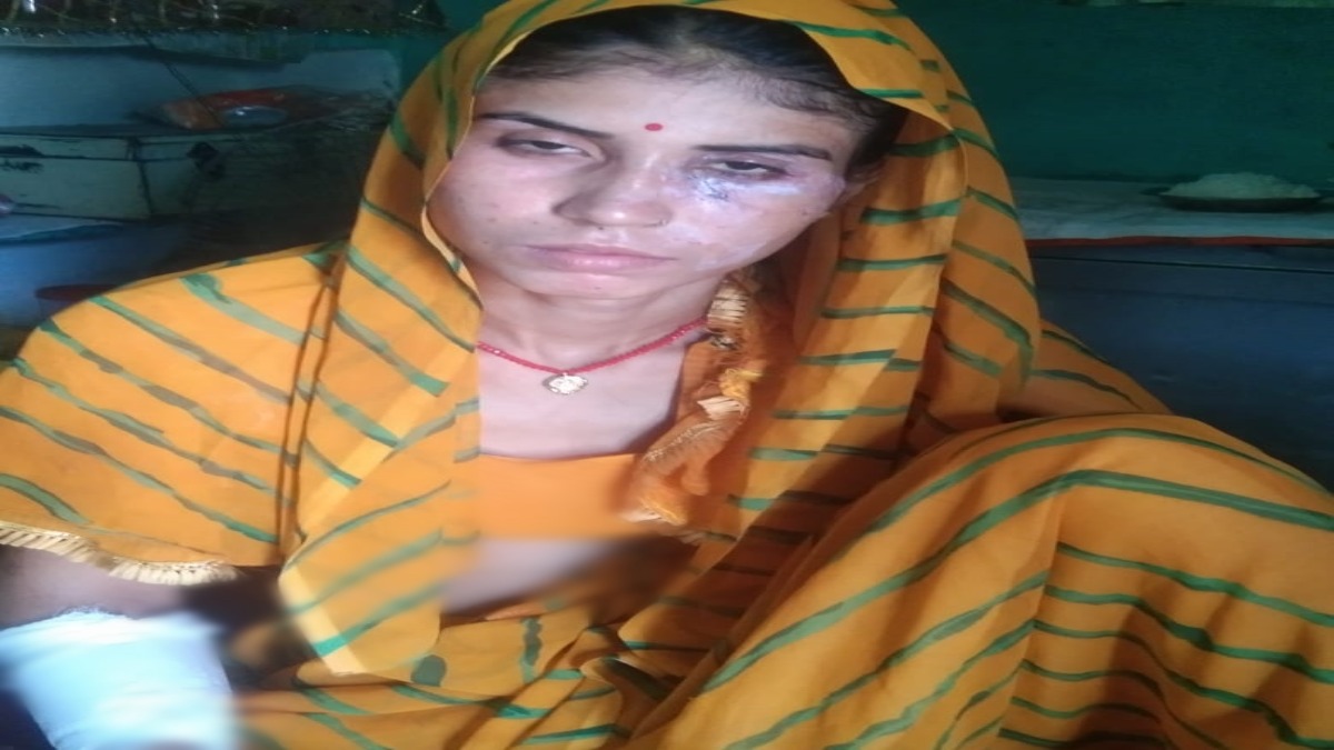 आपस में झगड़ रही थीं दो पड़ोसन, मामला शांत कराने पहुंची तीसरी महिला पर चाकू से किया हमला  