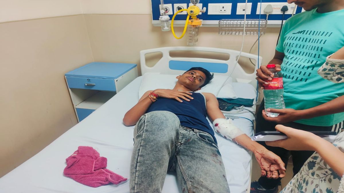 दो भाइयों के बीच चली गोलीः नाबालिग के कोहनी को फोड़ती हुई पेट में जा घुसी, आरोपी पर 10 हजार का इनाम