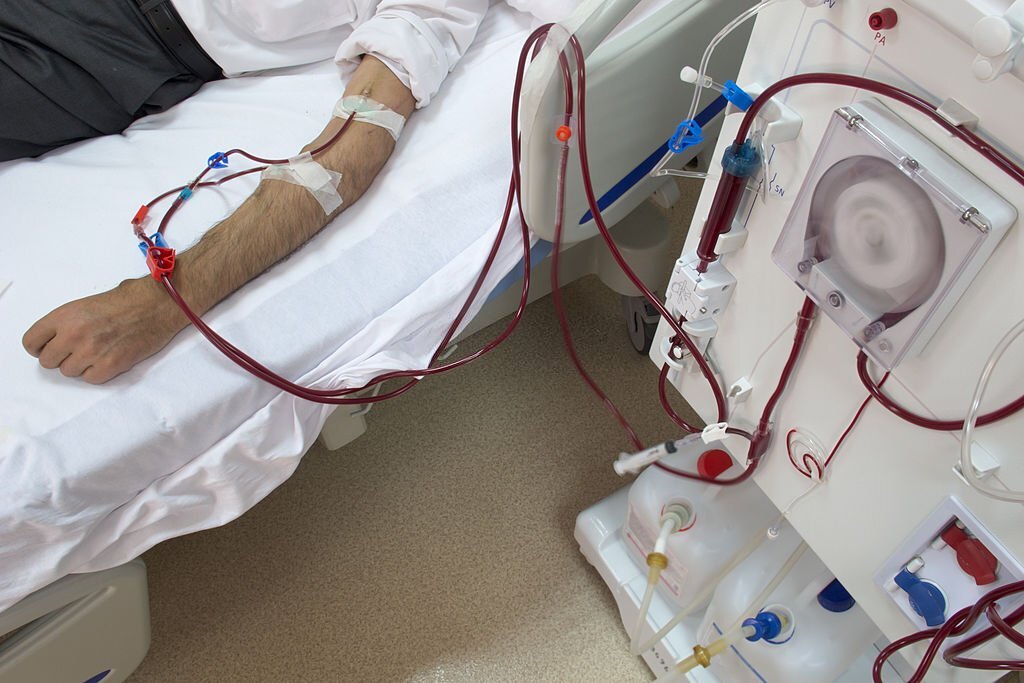 पंजाब : किडनी मरीजों को मिलेगी राहत, 40 डायलिसिस मशीनें खरीदेगा स्वास्थ्य विभाग