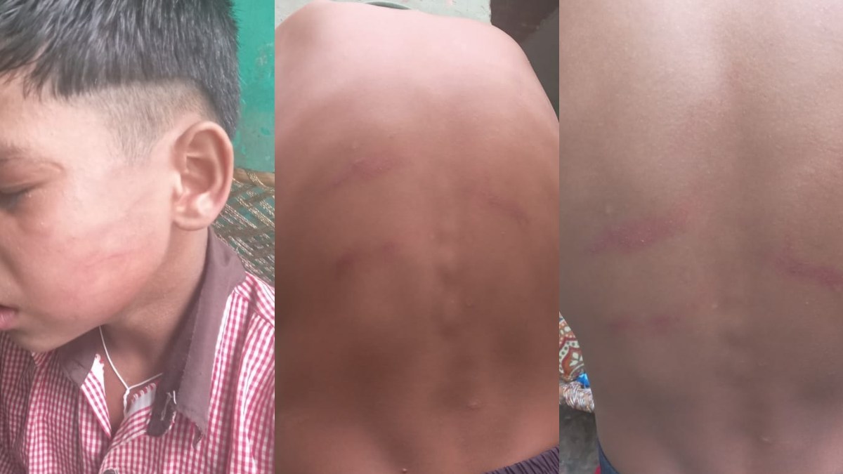 जाति है कि जाती नहीं : सरकारी स्कूल में दलित छात्र को शिक्षक ने पाइप से पीटा, दी जातिसूचक गालियां, शिकायत करने पर परिजनों को धमकाया