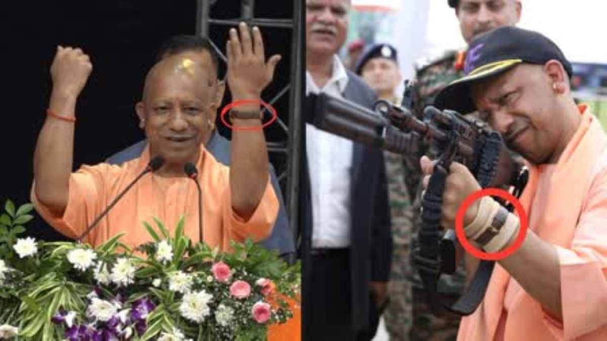 मात्र 30 सेकेंड में सीएम योगी का ठीक हुआ हाथ, खर्चा पूछा तो डॉक्टर बोले- सिर्फ एक सेल्फी