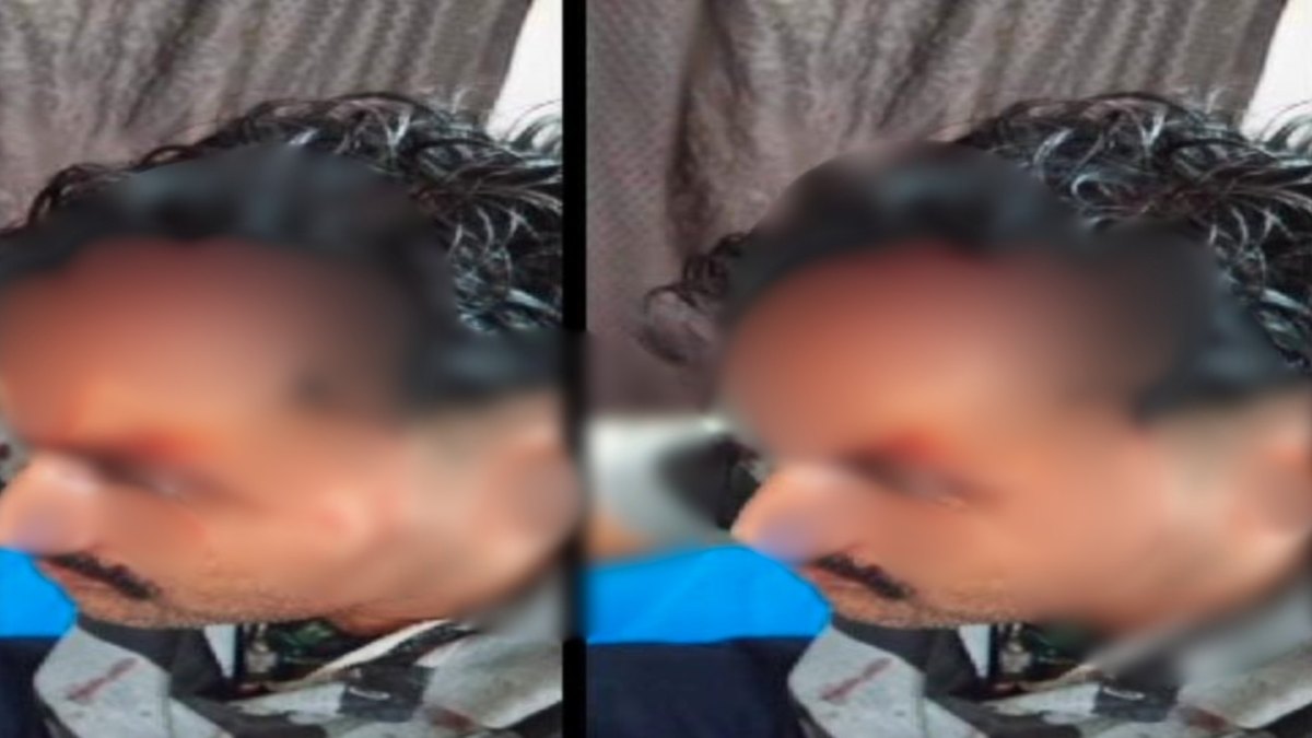 ASI पर जानलेवा हमला: बदमाशों ने दौड़ा-दौड़ाकर पीटा, फिर चलाई गोली, गंभीर हालत में अस्पताल में भर्ती, ये है पूरा मामला