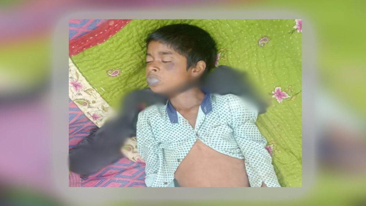 छत्तीसगढ़: पापा ने कहा, बेटा तंबाकू मत खाना… बेटे ने कर लिया सुसाइड