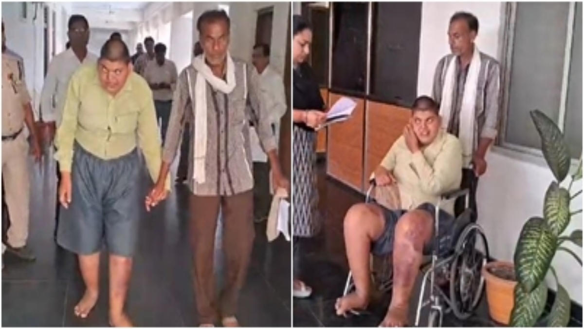 क्रूरता की हदें पार: मानसिक दिव्यांग युवक को बांधकर बेरहमी से पीटा, वजह जान चौंक उठेंगे आप   