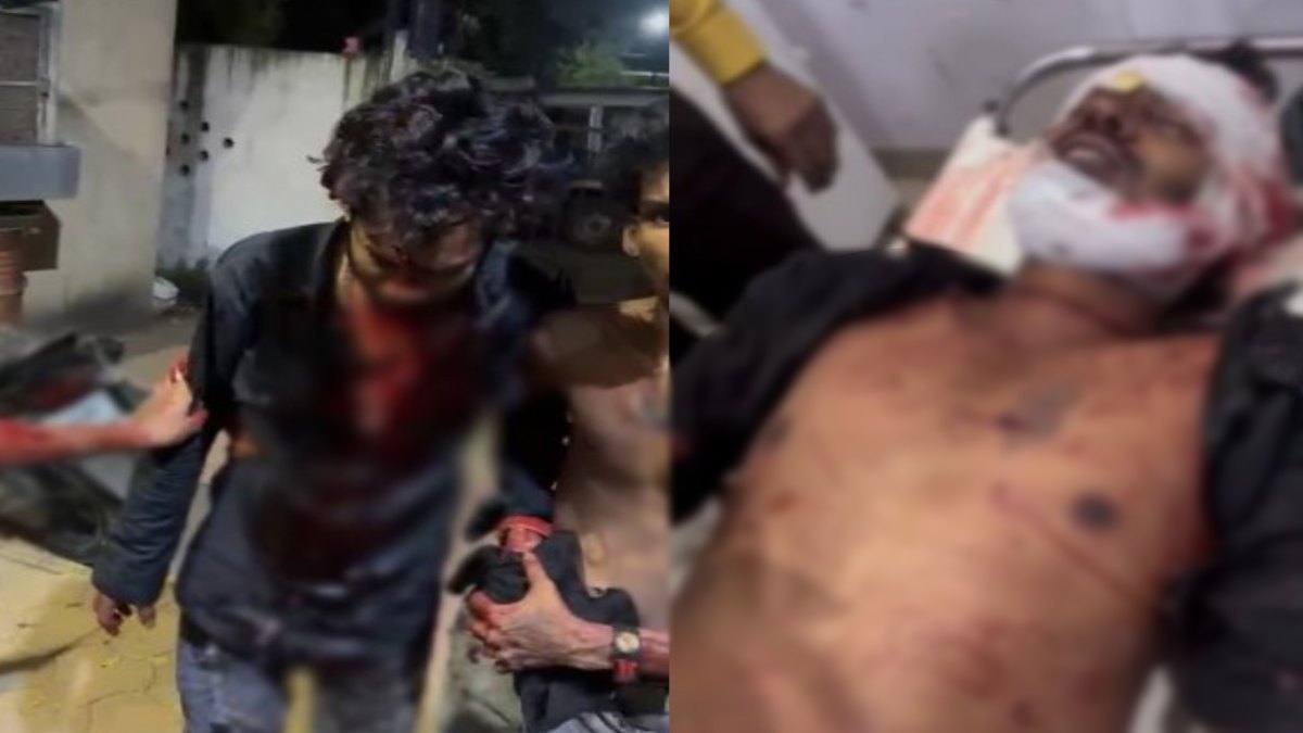 अपराधियों में नहीं पुलिस का खौफ… एक दूसरे के खून के प्यासे हुए युवक, तलवार से हमला कर किया लहूलुहान, 4 घायल