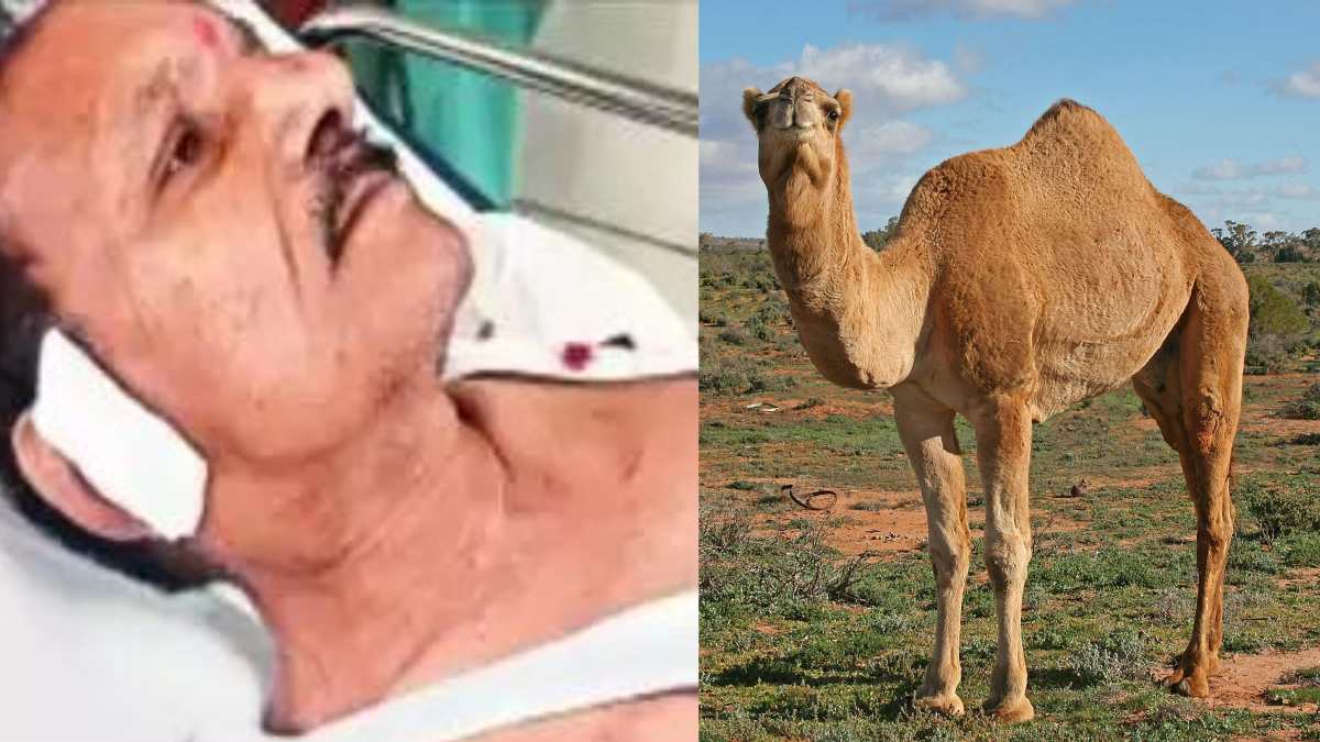 किस्मत खराब हो तो ऐसा भी होता है… पार्क में टहल रहे बुजुर्ग को ऊंट ने काटा, कान में लगाने पड़े 6 टांके, जानिए अनोखा मामला…