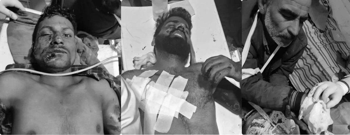 Ganderbal Terrorist Attack: गांदरबल आतंकी हमले की इनसाइड स्टोरी, टनल साइट पर काम कर रहे थे मजदूर तभी पहुंचे आतंकी और ताबड़तोड़ फायरिंग कर ले ली डॉक्टर सहित 7 लोगों की जान, गृह मंत्री शाह बोले- आतंकवादियों को बख्शा नहीं जाएगा