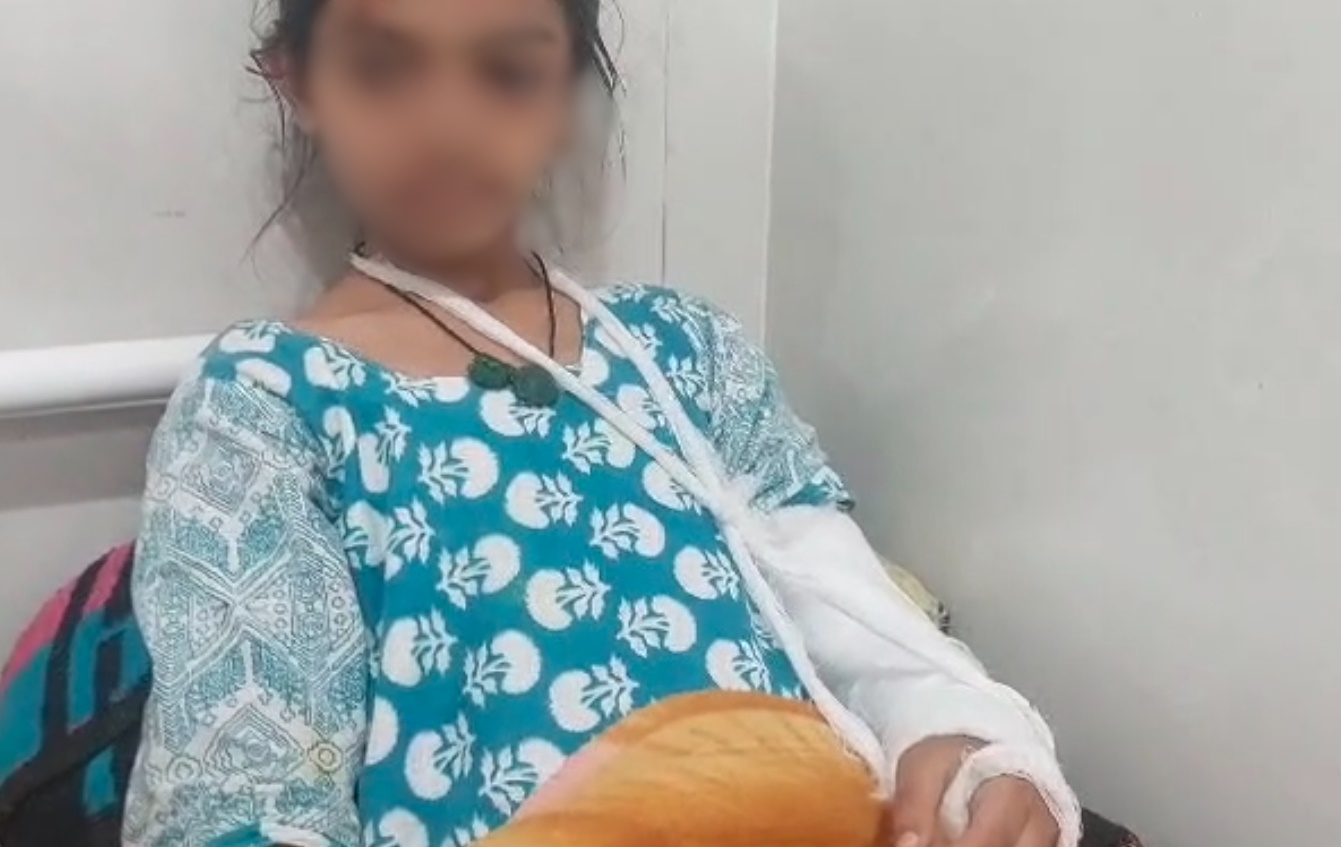 छात्रा को पंखे से उल्टा लटकाया…फिर पाइप से की जमकर पिटाई, प्रैक्टिस में न पहुंचने पर शिक्षक-शिक्षिका ने बर्बरता की सारे हदें की पार, हाथ फ्रैक्चर