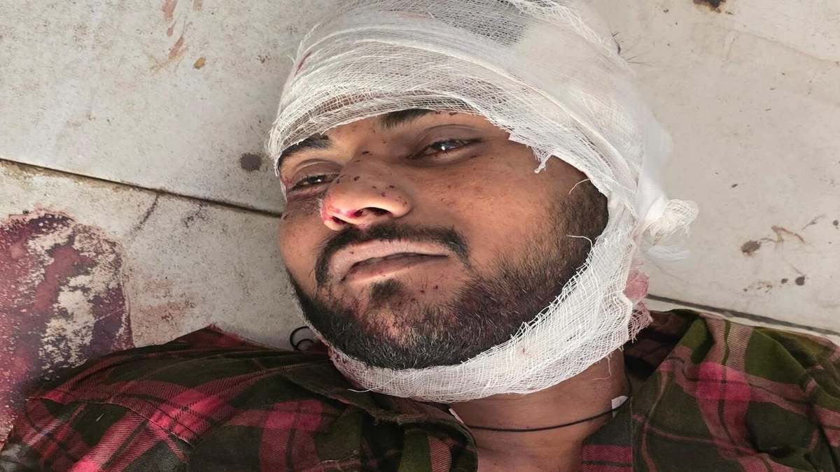 अपराधी अपराध छोड़ दें! UP पुलिस ने इनामी बदमाश का किया एनकाउंटर, क्रिमिनल पर दर्ज थे 50 से अधिक केस