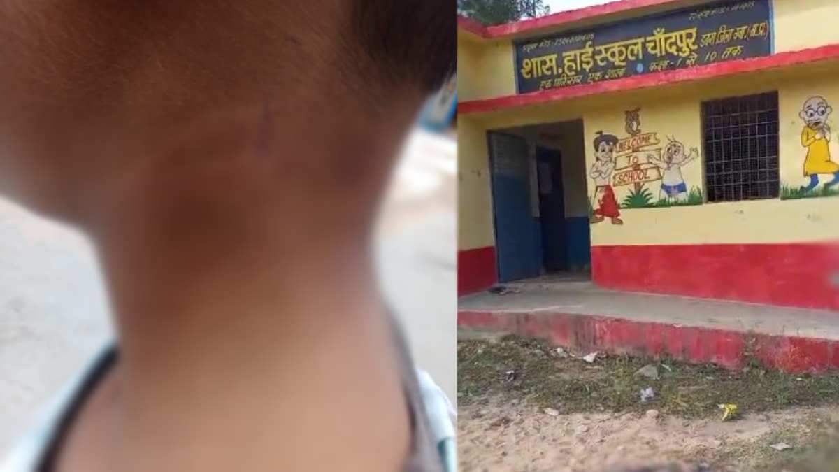 शिक्षिका की बर्बरता: बेरहमी से पिटाई कर छात्र के गले में मारा डंडा, परिजनों ने की कार्रवाई की मांग