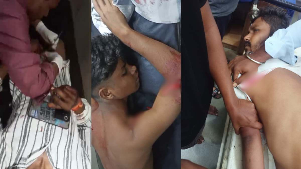 CG Crime News: चाकूबाजी और कटरबाजी की घटनाओं में 48 घंटों में 3 लोग पहुंचे अस्पताल, दोस्त ने प्राइवेट पार्ट पर किया वार, पुरानी रंजिश के चलते जानलेवा हमला