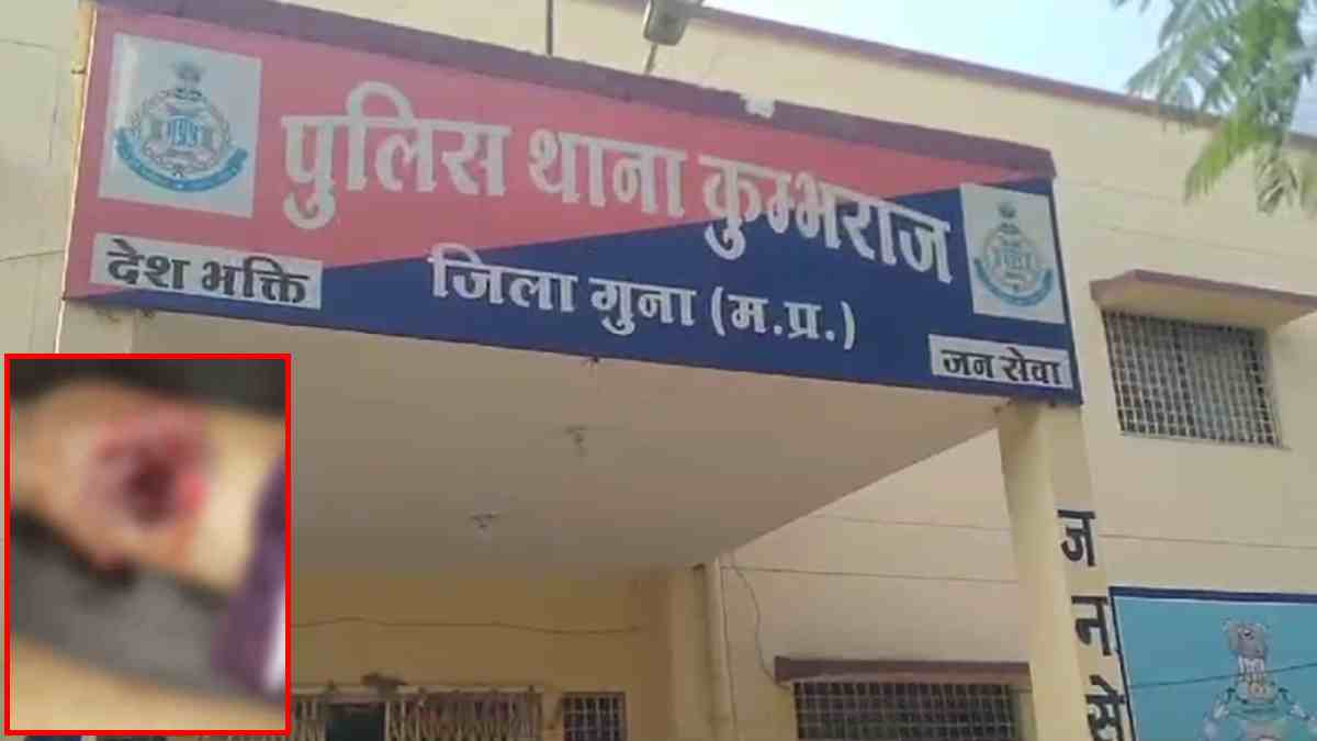 दो पक्षों के जमीनी विवाद में नाबालिग को मारी गोली, गंभीर हालत में अस्पताल में भर्ती, 6 पर मामला दर्ज