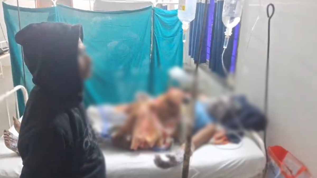 इधर सिलेंडर से हो रही थी गैस लीक, उधर जल रहा था चूल्हा, अचानक भड़की आग, परिवार के तीन लोग झुलसे