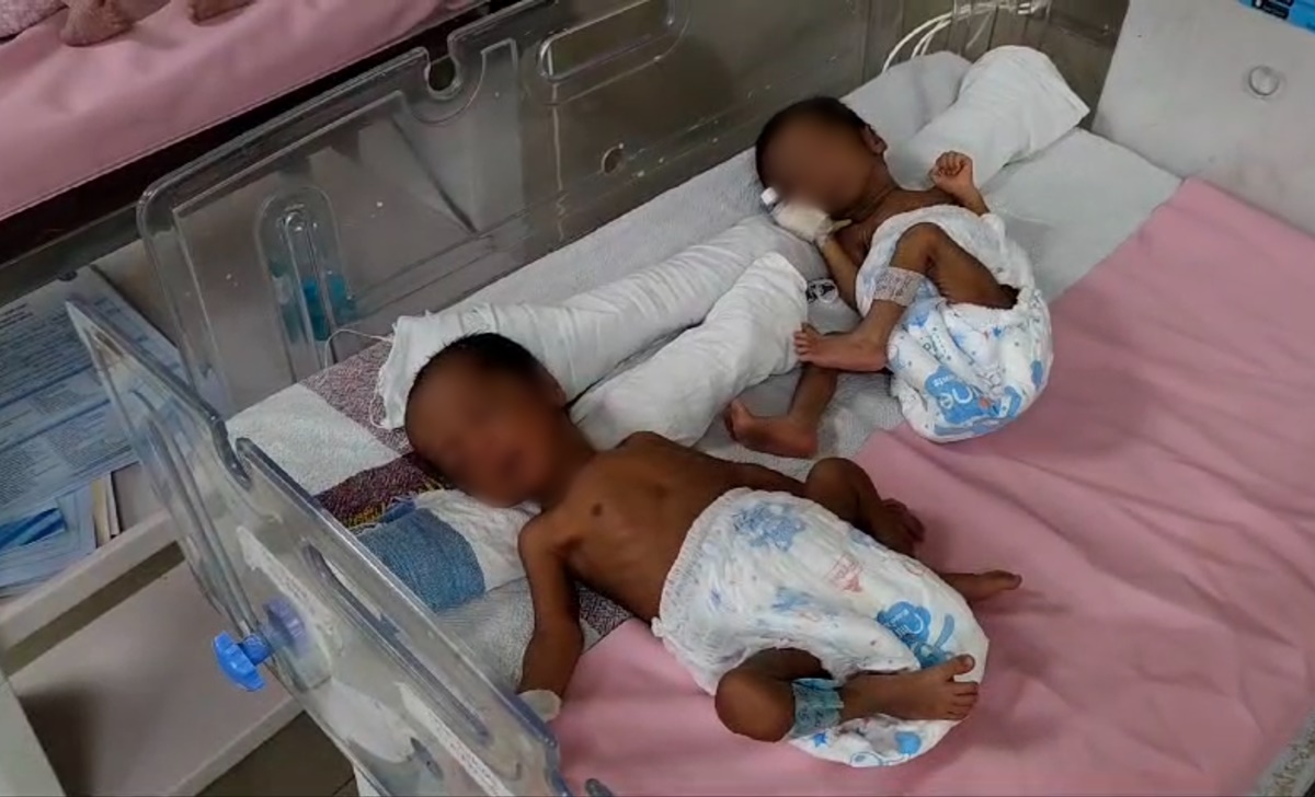अनोखा मामला: जिला अस्पताल में 7 दिन में 9 जुड़वा बच्चों का जन्म, हैरान हुए डॉक्टर, बोले- 30 सालों में पहली बार ऐसा देखा