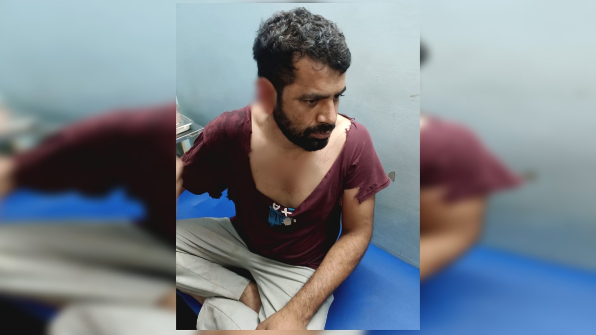 समझाइश देना पड़ा महंगा: बच्चों के झगड़े में युवक का कान काटा, मामूली धाराओं में केस दर्ज होने पर परिजनों का विरोध