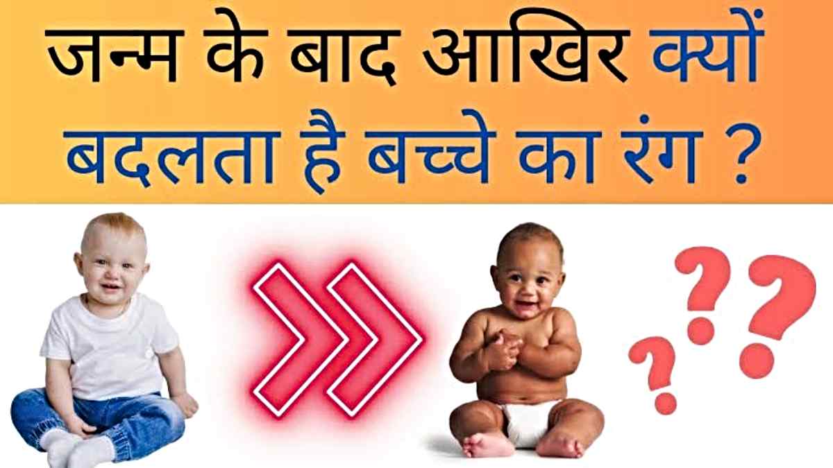 Child Care Tips: जन्म के कुछ समय बाद बदल गया है बच्चे का रंग, तो न हो परेशान और यहां जाने इसके पीछे का कारण….