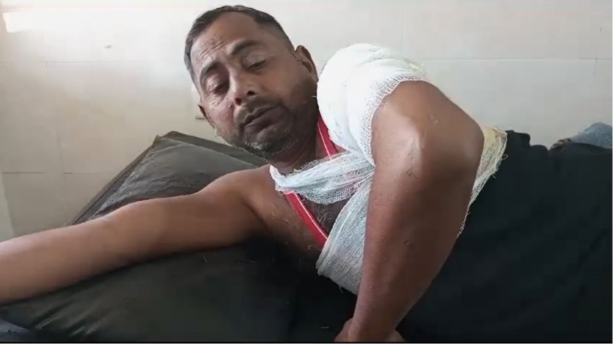 दो भाइयों में पुराना विवादः छोटे भाई की पत्नी ने जेठ पर  खौलता गरम पानी डाल किया घायल, अस्पताल में भर्ती