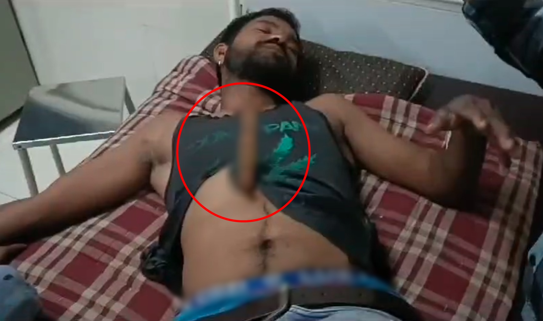 युवक ने खुद के पेट पर घोंपा चाकू, अस्पताल पहुंचकर बोला- जल्दी निकालो चुभ रहा है…, घंटों करता रहा डॉक्टर का इंतजार
