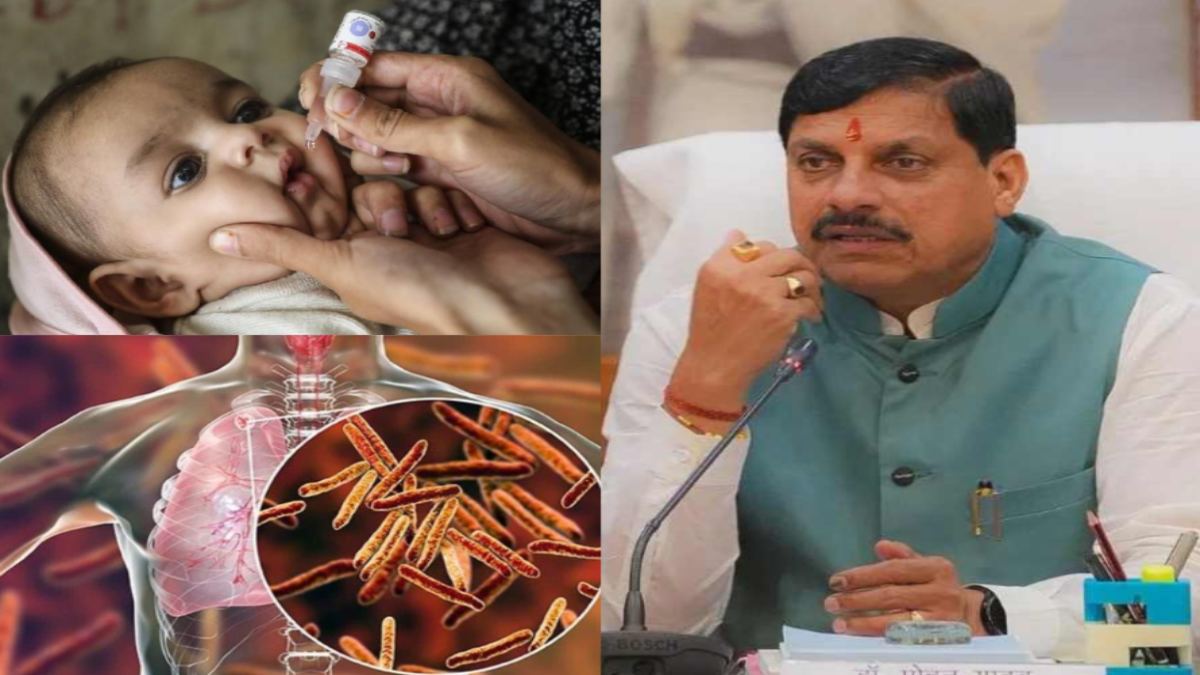 MP में पल्स पोलियो और टीबी मुक्त अभियान, CM डॉ मोहन ने प्रदेशवासियों से की ये अपील