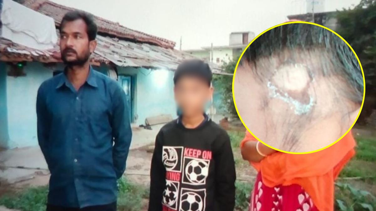 शिक्षक या राक्षस ? छात्र से क्रूरता की हदें पार, टीचर ने उखाड़ दिए बाल, इतनी सी बात पर दे दी सजा…
